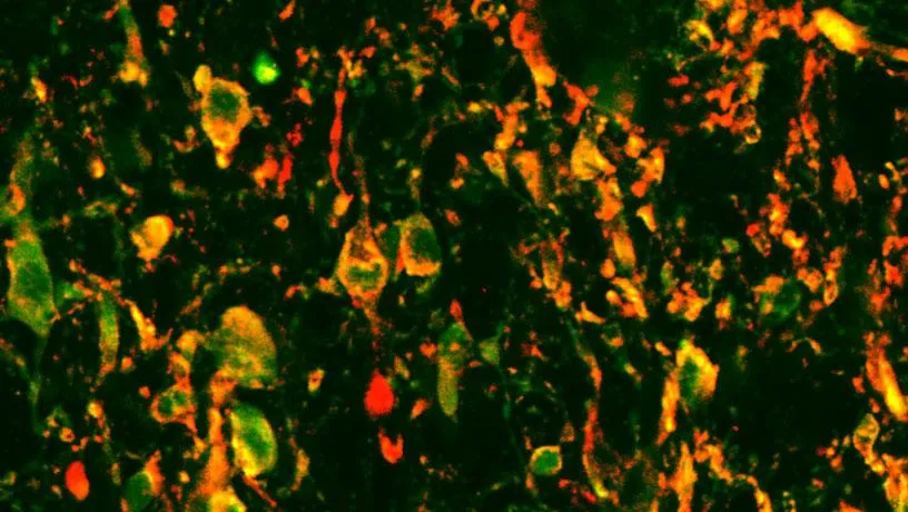 Tuning Arousal to Boost Information Transmission in the Brain