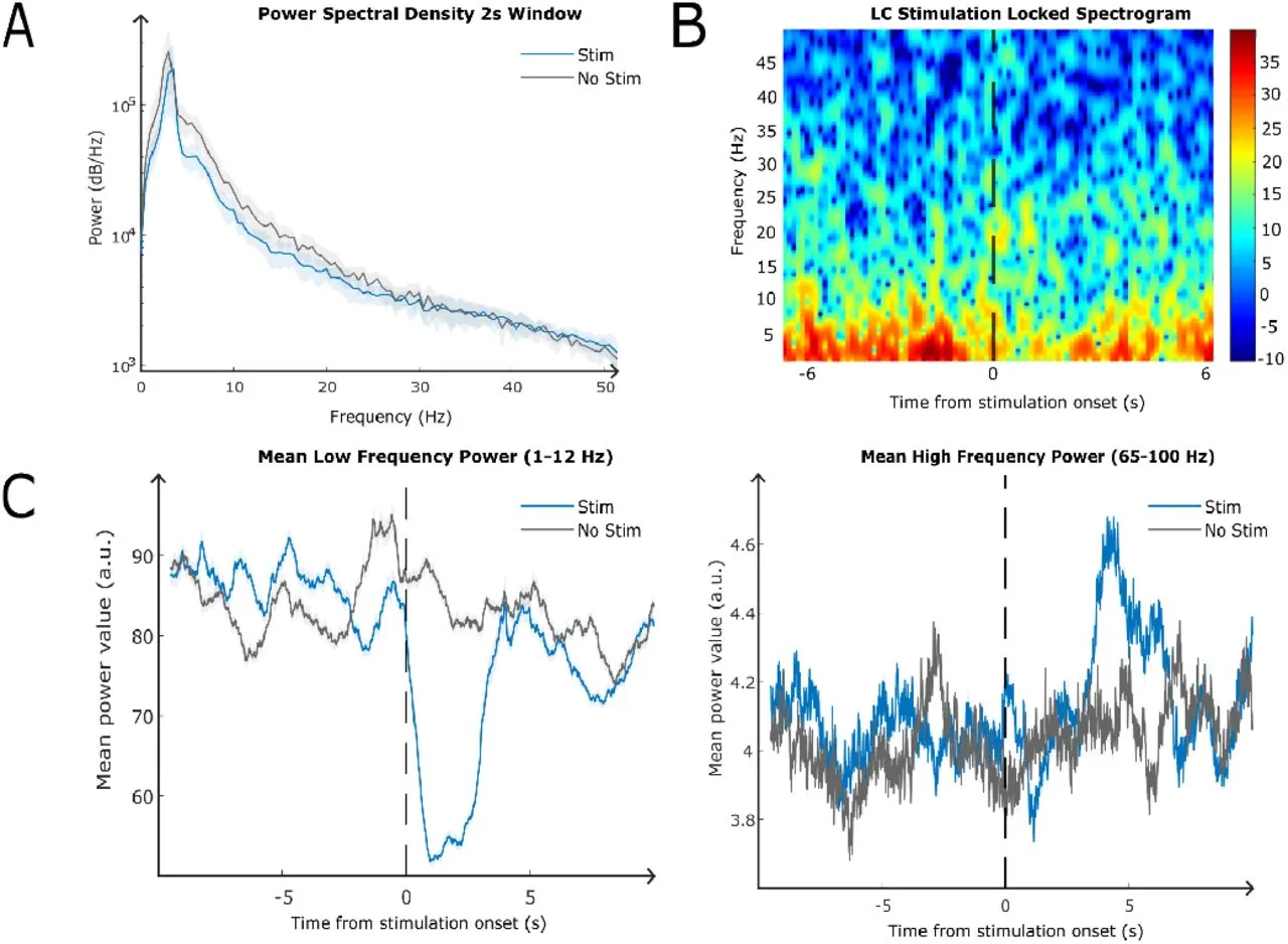 Optogenetic Locus Coeruleus Stimulation Improves Pupil Size Tracking of Cortical State